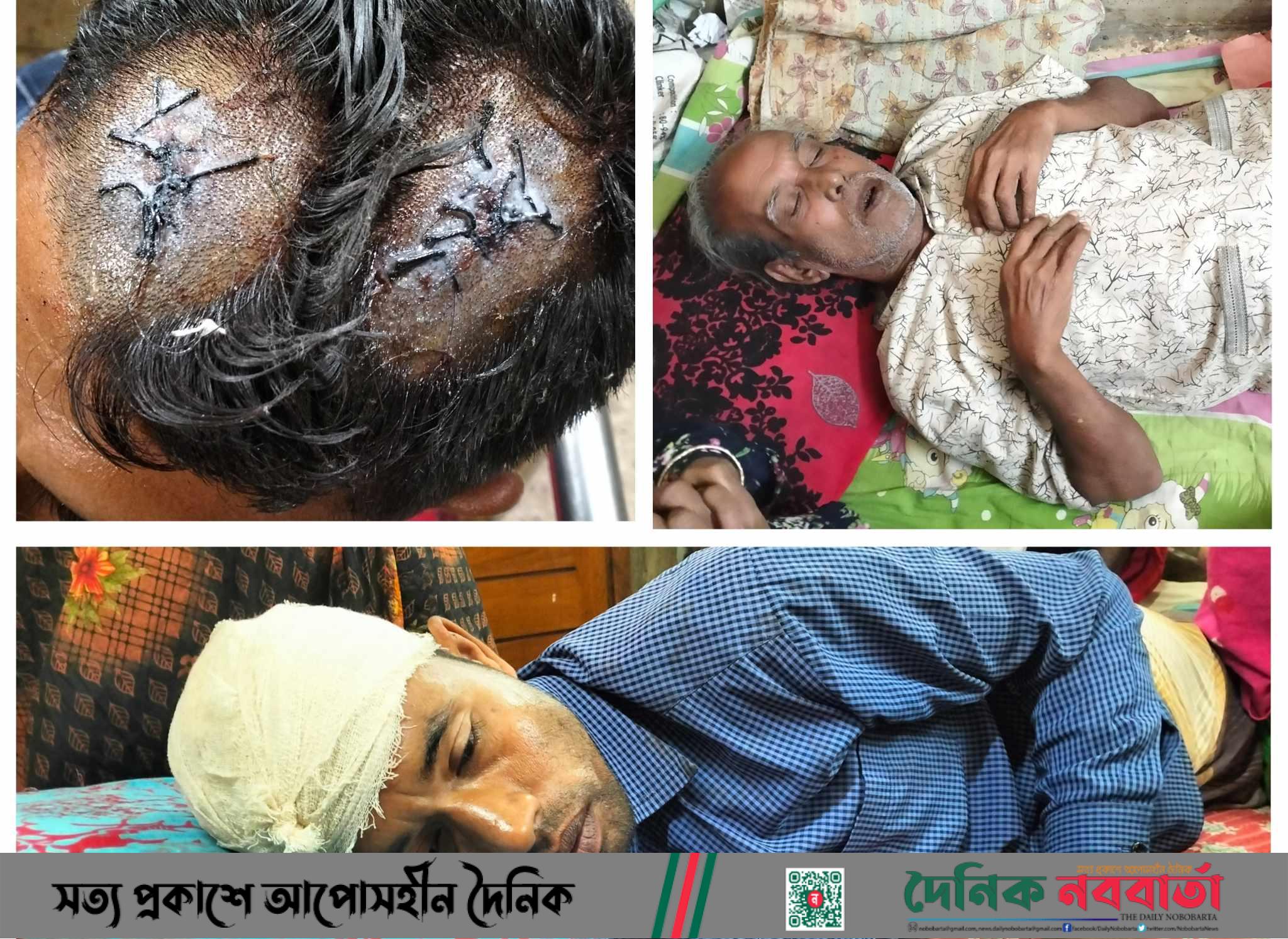 শেরপুরে মেয়েদের জমি লিখে দেয়ায় প্রতিপক্ষের হামলায় আহত-২