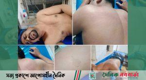 মানিকগঞ্জ-১ আসনের স্বতন্ত্র প্রার্থীর কর্মীকে মারধরের অভিযোগ